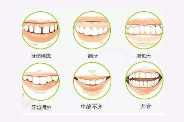 牙齿松动还能做烤瓷牙吗(牙齿松动还能做烤瓷牙吗多少钱)