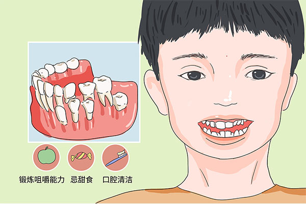 乳牙滞留应该怎么办呢吃什么药治疗