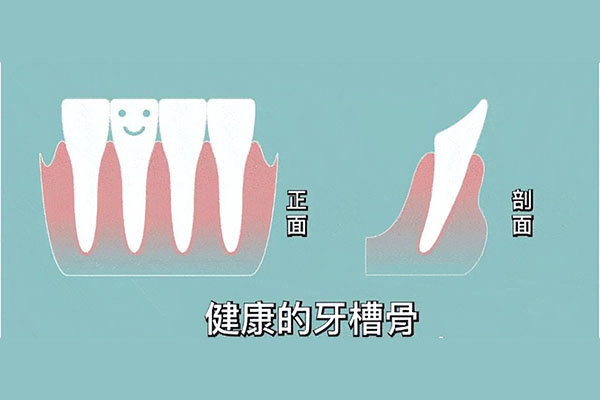 牙体缺损修复时一定要建立良好的固