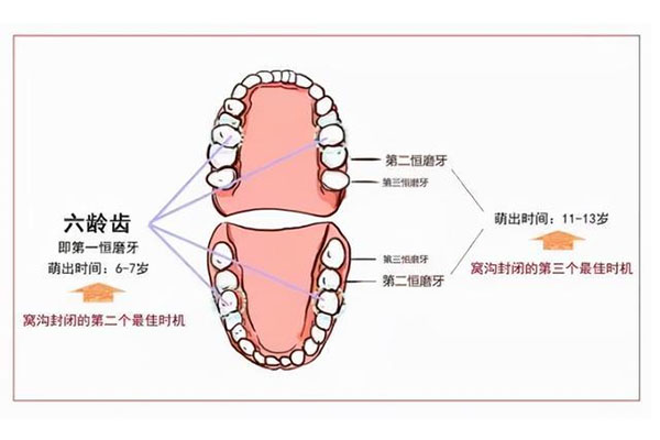 孩子六龄齿在什么位置(小孩六龄齿是