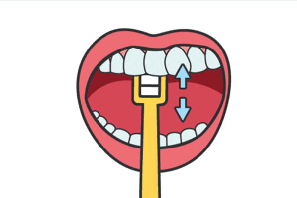 5秒脱落牙结石 洗牙多少钱(5秒脱落牙