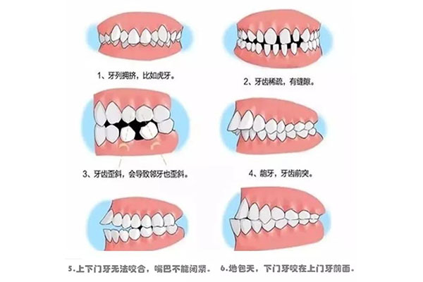 牙不齐有什么说法佛法(牙不齐是不是