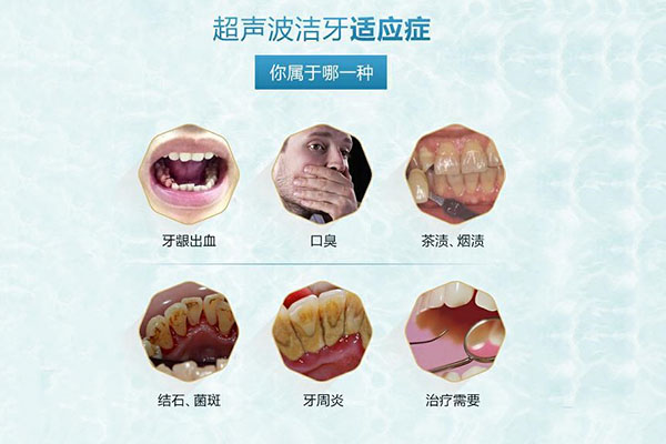 洗牙的费用能报销吗多少钱啊