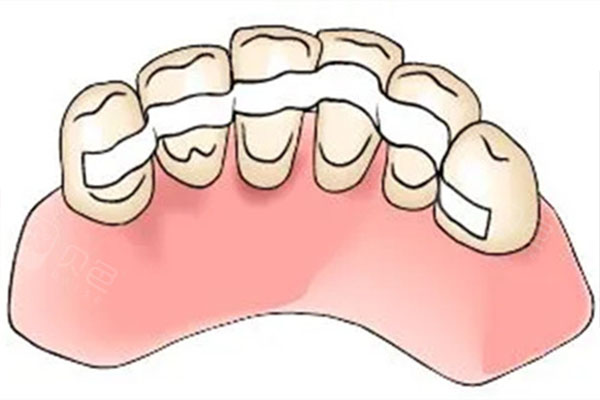 下牙重度拥挤怎么办吃什么药效果好(下牙重度拥挤怎么办吃什么