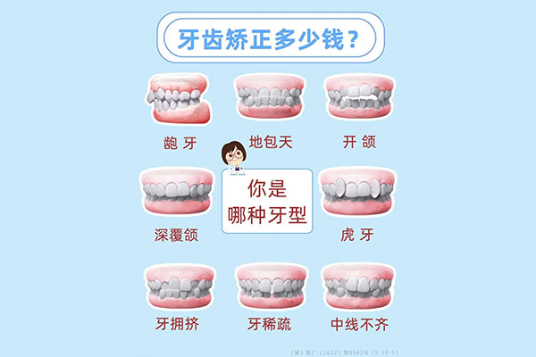 牙齿矫正14岁晚吗(14岁矫正牙齿晚不晚)