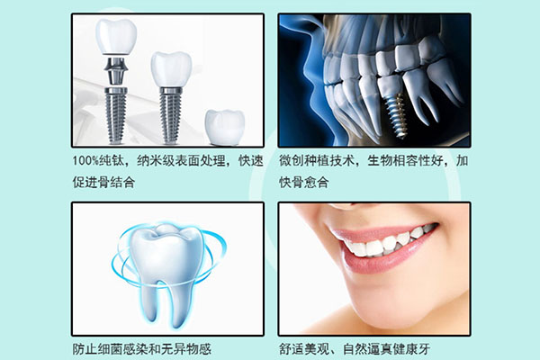 种牙一般价格(种牙一般价格多少钱