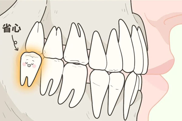 智齿是什么病种吗(智齿属于什么疾病)