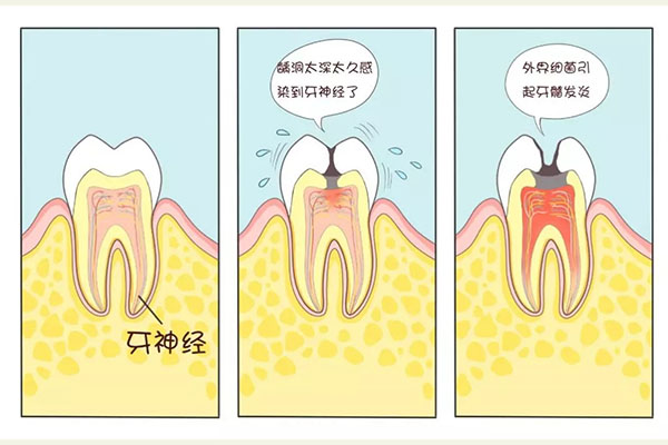 宝宝蛀牙牙齿疼怎么缓解一下呢(宝宝蛀牙牙齿疼怎么缓解一下呢