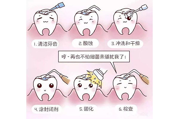 牙面涂氟多少钱一颗牙(牙面涂氟多少钱一颗牙图片)