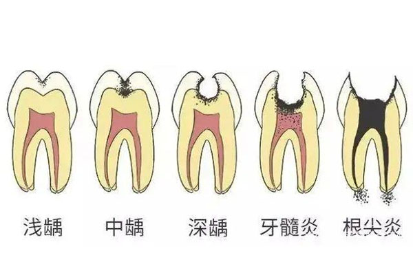 牙周炎牙齿松动怎么治疗好(牙周炎牙齿松动怎么治疗好的快)