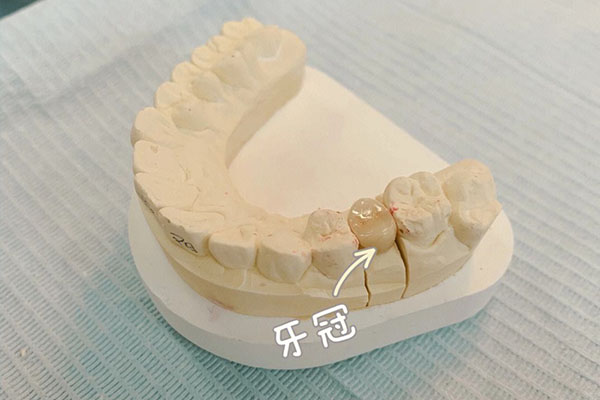 义齿加工有限公司总监工资(义齿加工有限公司总监工资待遇)