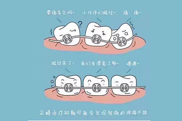 什么是深覆盖性肺炎