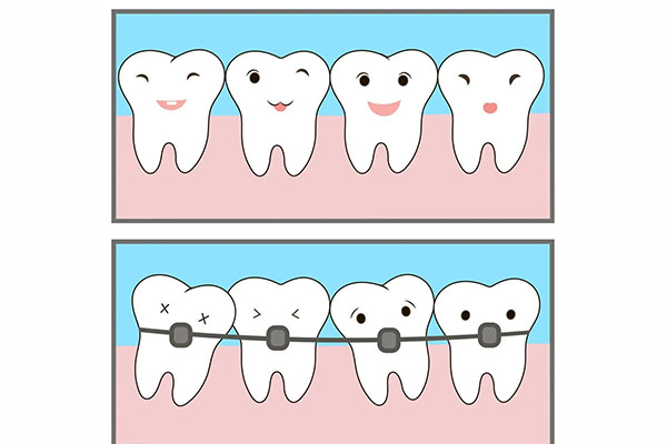12岁牙齿正畸会反弹吗为什么(12岁牙齿