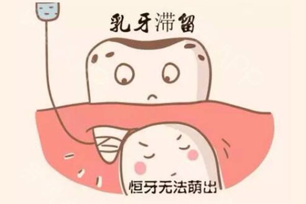 上颚乳牙滞留的原因(上颚乳牙滞留的原因是什么)