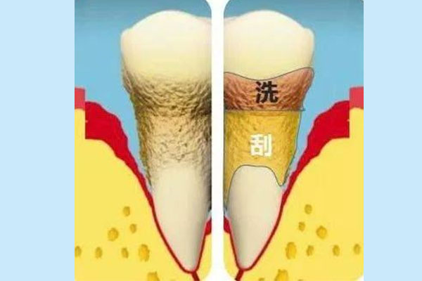 30岁牙龈萎缩能恢复吗为什么还会萎缩(30岁牙龈萎缩能恢复吗为