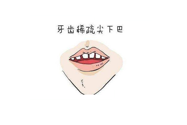 牙齿稀疏牙缝大可以补牙吗多少钱一