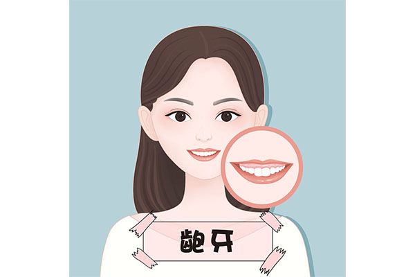 功夫中龅牙妹(功夫龅牙妹叫什么名字