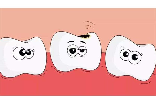 12岁孩子蛀牙(12岁孩子蛀牙怎么办)