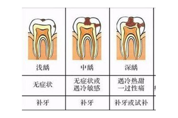 20多岁蛀牙太多怎么办,老了怎么办(