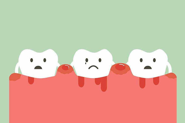 一刷牙牙龈就出血是怎么回事儿