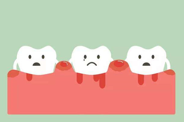 一刷牙就牙龈出血怎么回事吃什么药管用