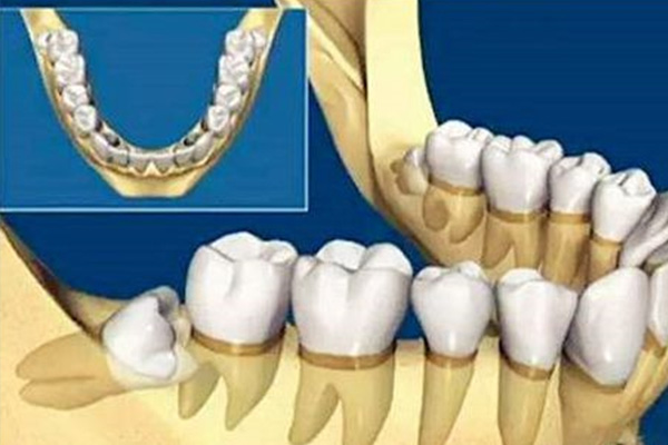 4颗智齿长在什么位置(4颗智齿长在什么位置图片)
