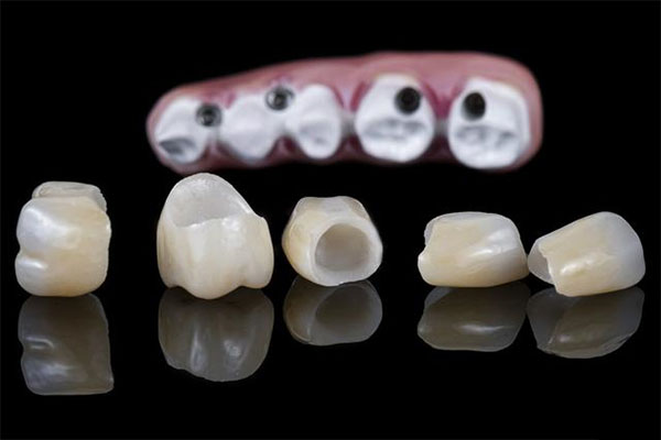 3m纳米树脂补牙医保有报销吗(3m纳米树脂补牙和一般补牙的区别