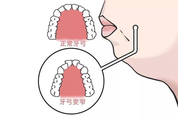 一般医院拔一颗智齿多少钱(一般医院