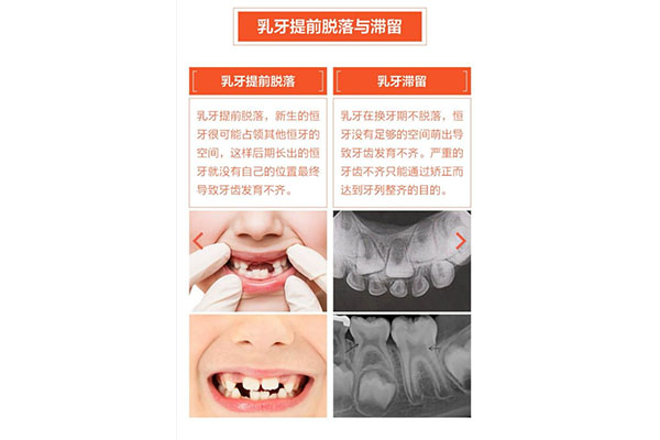 乳牙滞留临床表现有哪些方面的表现(乳牙滞留临床表现有哪些方