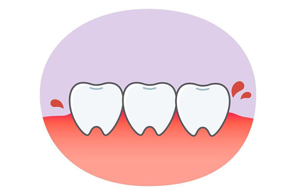 一岁宝宝牙龈出血怎么回事