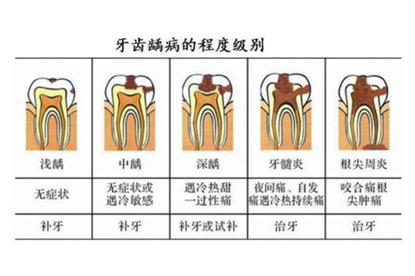 13岁孩子虫牙可以用药物治疗吗为什么