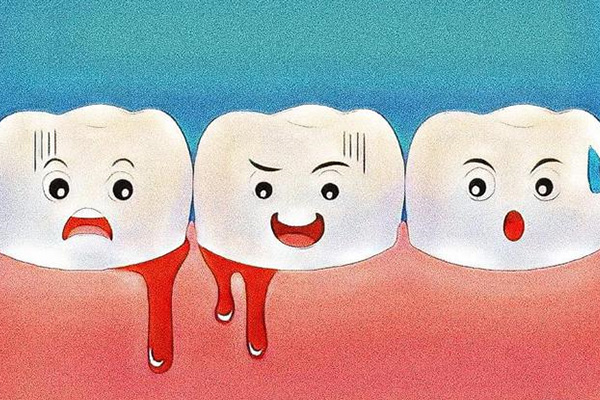 一刷牙就出血是怎么回事儿