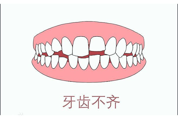 8岁的孩子换牙后牙齿不齐怎么办(8岁的孩子换牙后牙齿不齐怎么