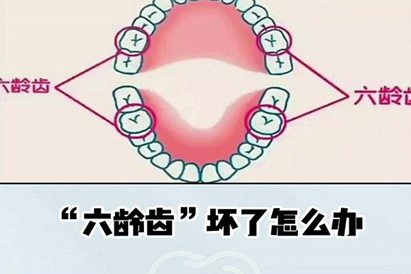 七岁六龄齿歪了45度(七岁六龄齿歪了45度怎么办)