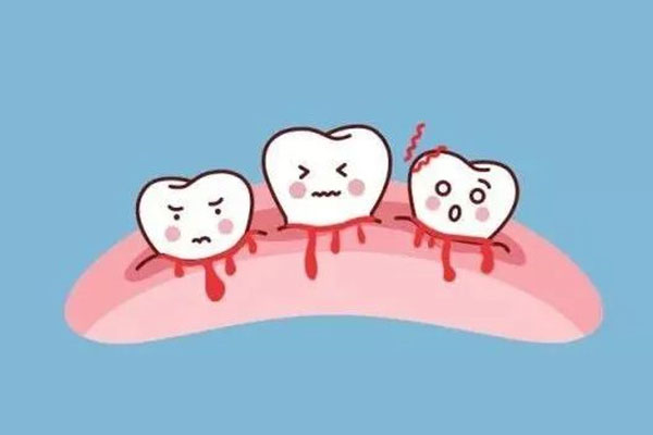 一刷牙牙龈就出血怎么办 医生说没事