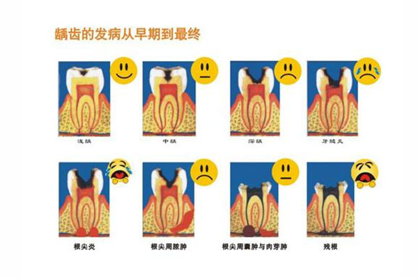 20多岁牙齿蛀牙掉了怎么办呀(20多岁牙齿蛀牙掉了怎么办呀怎么