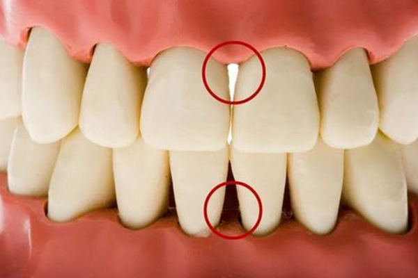 38岁牙龈萎缩正常吗怎么治(38岁牙龈萎缩正常吗怎么治疗好)