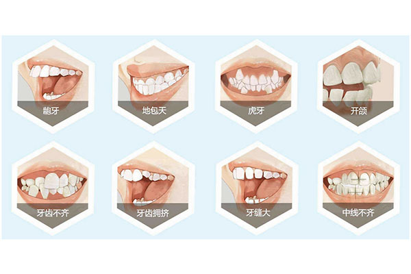 儿童牙齿中线不齐如何矫正好(儿童牙齿中线不齐如何矫正好图片