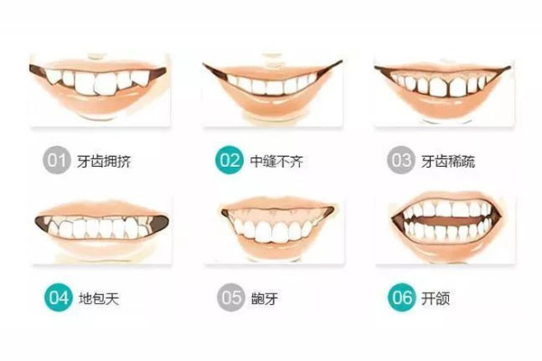 儿童反颌牵引器大概多少钱(儿童反颌牵引器大概多少钱一次)还