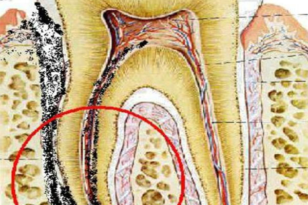 牙体缺损修复术可以用医保吗(牙体缺损修复术可以用医保吗多少