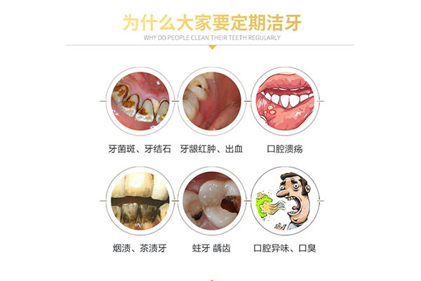 喷砂洁牙跟超声波洁牙(喷砂洁牙跟超