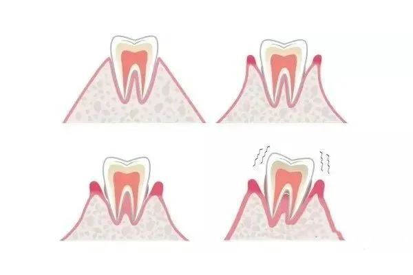 40多岁男人牙齿松动怎么回事(40多岁男人牙齿松动怎么回事儿)