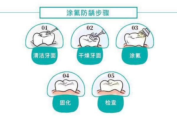 14岁窝沟封闭好还是不封闭好(14岁做窝沟封闭晚不晚)