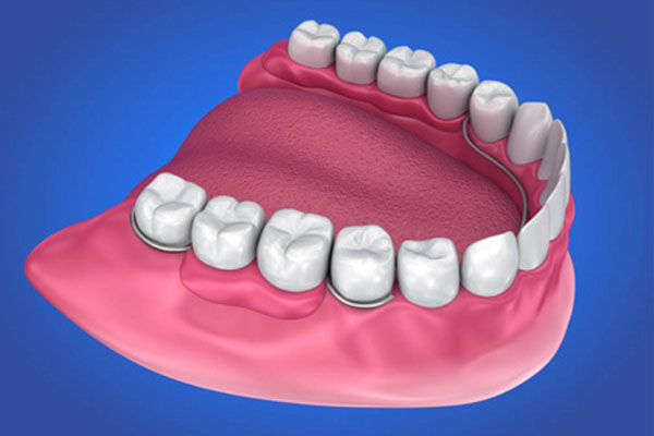 3d烤瓷牙是什么材质做成的(3d烤瓷牙是