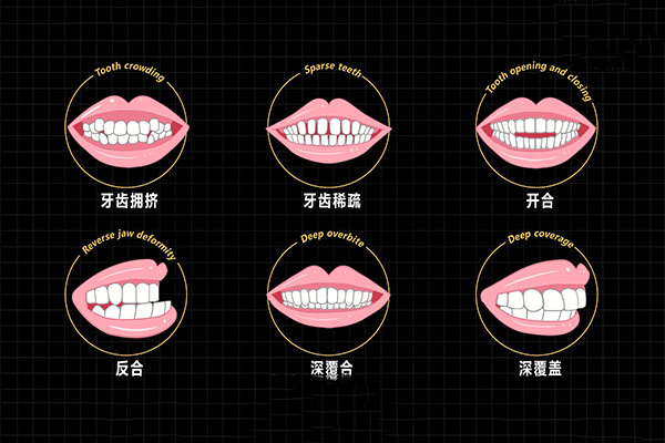 50岁的牙齿松动怎么办(50岁牙齿松动怎么办要吃什么)