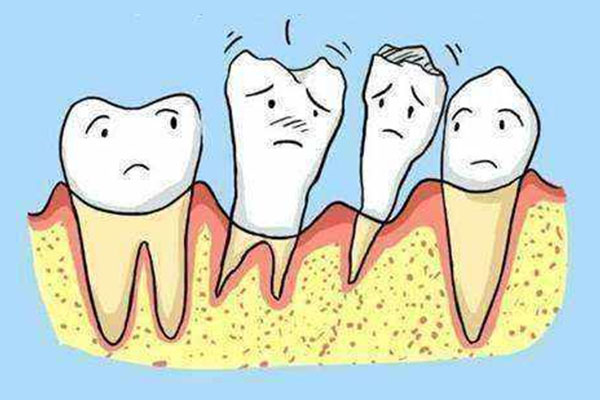 严重牙周炎牙龈萎缩牙齿松动能恢复