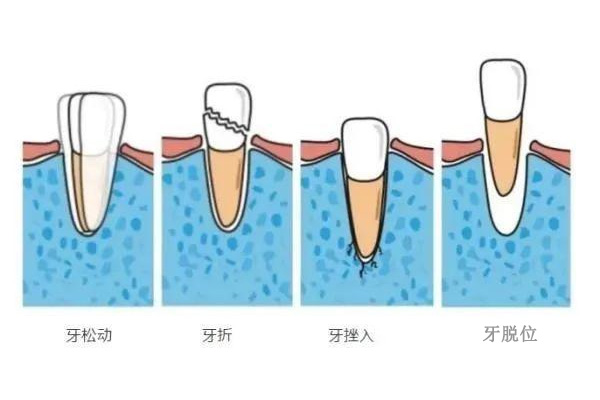 50岁牙齿用手晃有点松动怎么回事啊(50岁牙齿用手晃有点松动怎