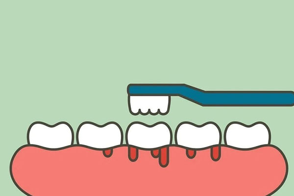 牙齿有结石会口臭吗吃什么药(牙齿有结石会口臭吗吃什么药效果