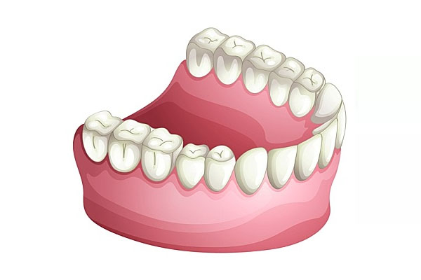 60岁老人牙齿脱落怎么办(60岁老人牙齿